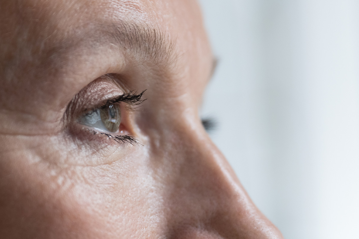 Primer plano de perfil del ojo de un paciente, enfocado en el párpado y las pestañas.
