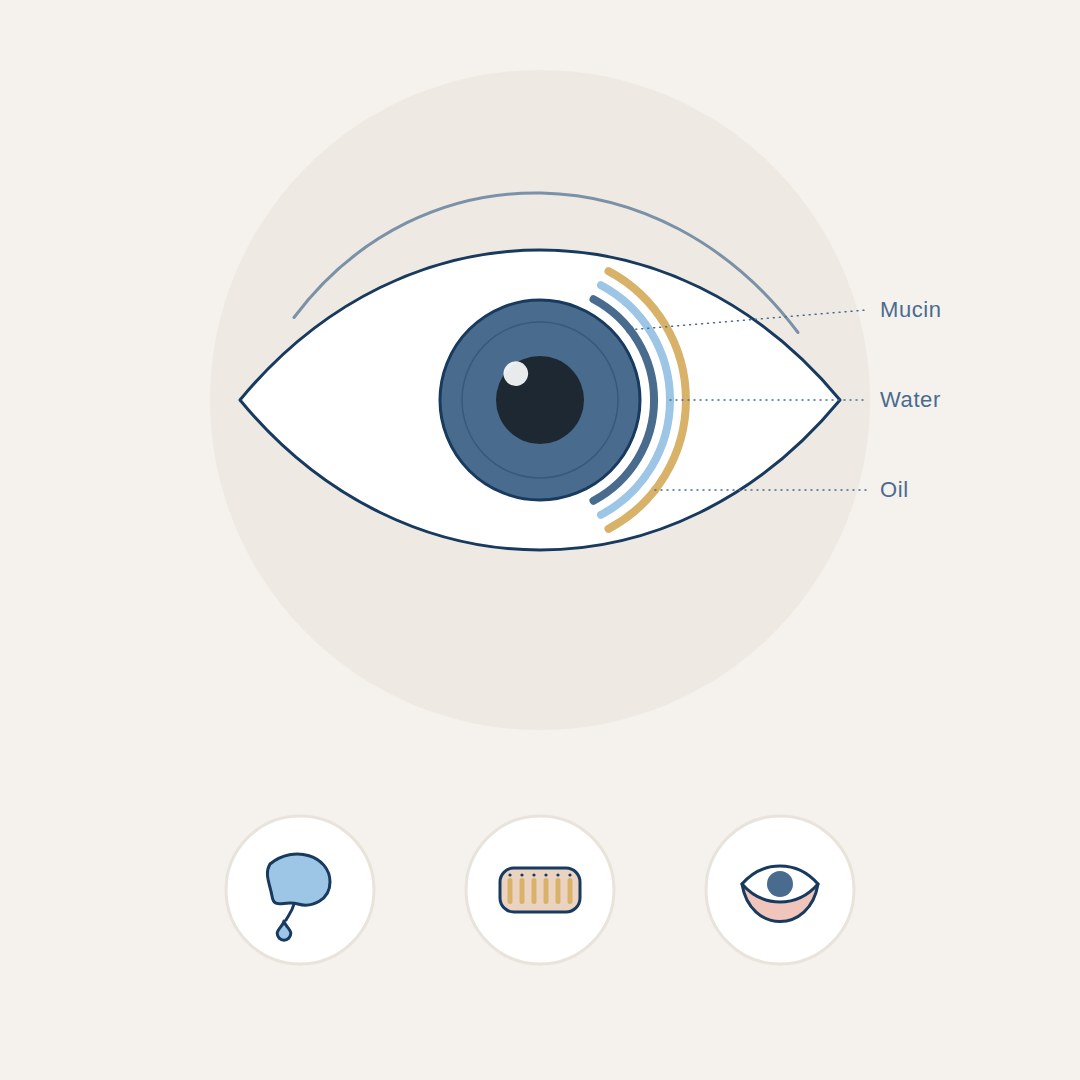 Illustration of the three causes of dry eye: a tear gland producing too little fluid, blocked meibomian oil glands in the eyelid, and an eyelid that does not close fully
