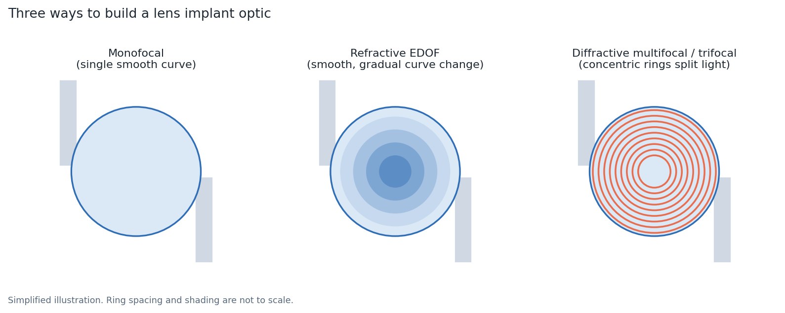 Illustration of three lens implant optic designs: a monofocal with a single smooth curve, a refractive extended depth of focus lens with a gradual curve change, and a diffractive multifocal with concentric rings