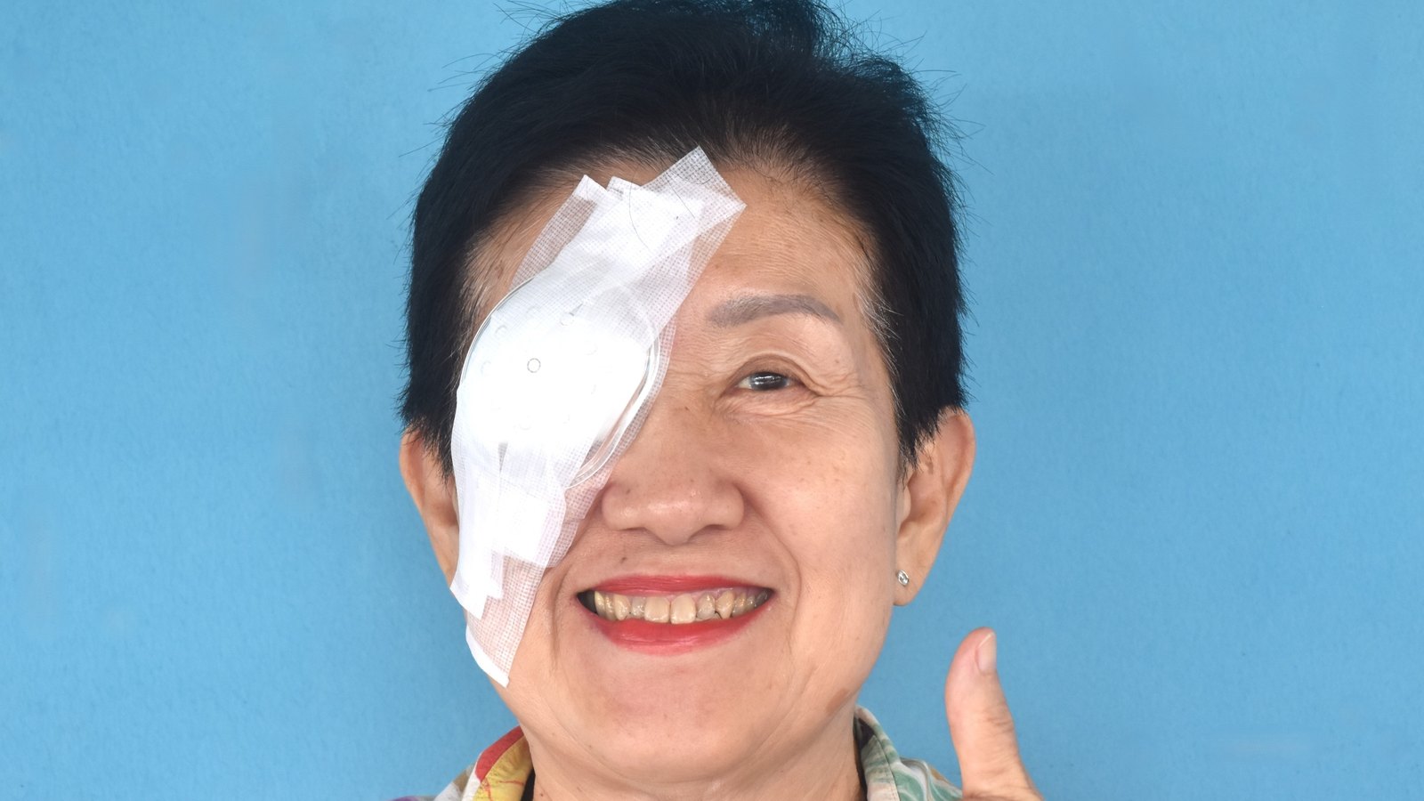 Mujer mayor sonriente con un protector ocular después de la cirugía de cataratas