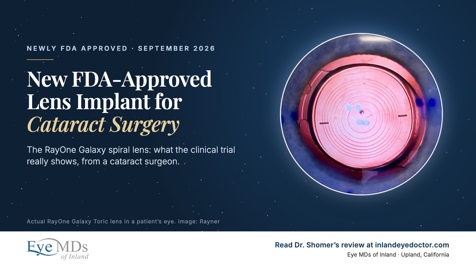 Photograph of an actual RayOne Galaxy Toric lens implant in a patient&rsquo;s eye, showing its spiral optic rings and toric axis marks, beside the headline New FDA-Approved Lens Implant for Cataract Surgery