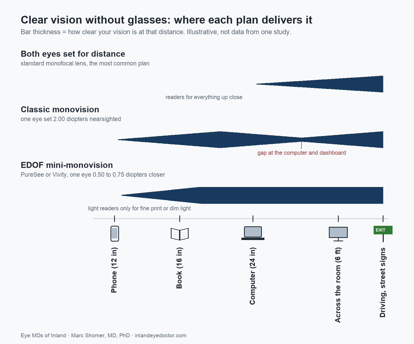 Chart of clear vision without glasses at phone, book, computer, room and driving distances for three cataract surgery plans: both eyes set for distance, classic monovision with a two diopter difference, and EDOF mini-monovision, which gives one continuous range from driving to book distance